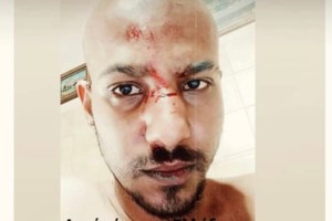 Ηράκλειο: Δεύτερη φορά έστειλε την πεθερά του στο νοσοκομείο - Σοκάρουν οι λεπτομέρειες του ξυλοδαρμού - εικόνα 2