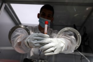 "Κορονοϊός: "Φλέγεται" η Αττική με 741 νέα κρούσματα – "Εκρηξη" στο κέντρο της Αθήνας - Ανεβαίνουν και στη Θεσσαλονίκη - εικόνα 6