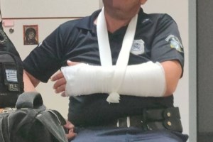 Απίστευτο περιστατικό βίας στη Λάρισα: Έσβησε τσιγάρο στο πόδι 15χρονης γιατί δεν δέχτηκε τις σεξουαλικές του προτάσεις