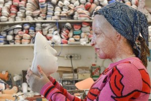 Ιωάννα Παλιοσπύρου: Νέα φωτογραφία χωρίς τη μάσκα - Δείχνει το πρόσωπό της και τα εγκαύματα [Εικόνα]