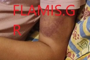 Εξελίξεις στην υπόθεση κακοποίησης 16χρονης στην Πάτρα: Συνελήφθησαν τρία άτομα για την αρπαγή της - Στο νοσοκομείο η ανήλικη