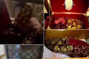 Ελληνικά Hoaxes: Fake news ότι έρευνα έδειξε πως η κολονοσκόπηση είναι υπερτιμημένη μέθοδος διάγνωσης καρκίνου