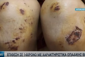 Λάρισα: Άγριος ξυλοδαρμός 17χρονου μαθητή ΕΠΑΛ από τέσσερις ανηλίκους- Συνελήφθη 16χρονος