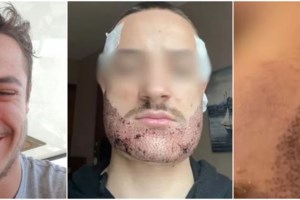 Βαριά σκιά στο Πανεπιστήμιο της Οξφόρδης: 20χρονος δεν άντεξε το μπούλινγκ και αυτοκτόνησε - Τον είχαν κάνει cancel - εικόνα 2