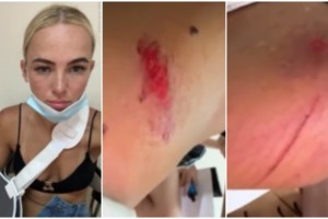 Εγκλημα στην Κέρκυρα: Με κουζινομάχαιρο χτύπησε τον 68χρονο - Οι συνεχείς καβγάδες και τα θέματα αλκοολισμού της 49χρονης - εικόνα 7