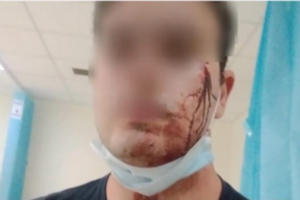 Σοκ στη Ρόδο: Βγήκαν μαχαίρια για μια θέση πάρκινγκ – Στο νοσοκομείο ένας αστυνομικός