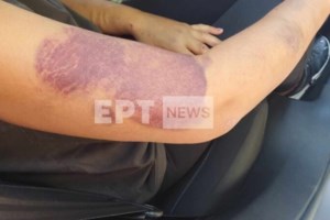 Διδυμότειχο - Το ιατροδικαστικό πόρισμα: Τη βίαζε επανειλημμένα και τη χτυπούσε με ξύλο - Την… έβγαζε βόλτα με μάσκα και γυαλιά - εικόνα 2