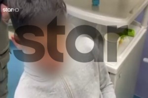 Μέγαρα: Ένταλμα σύλληψης για απόπειρα ανθρωποκτονίας εκδόθηκε για τον 23χρονο που ξυλοκόπησε το 4χρονο αγοράκι - εικόνα 2