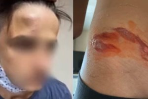 Εξαφάνιση 14χρονης στην Ξάνθη: Για αρπαγή κάνει λόγο η οικογένεια - Ο ρόλος του 21χρονου φίλου της