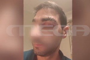 Αίγιο: Περιτονίτιδα και ισχαιμικό επεισόδιο έδειξε η νεκροψία για τον θάνατο του 43χρονου μποξέρ