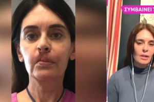 Συγκλονίζει η Κατερίνα Πλουμιδάκη: "Στις 40 εγχειρήσεις θα είμαι καλύτερα" - Όσα αποκάλυψε η συγγραφέας για τις επεμβάσεις στα χείλη