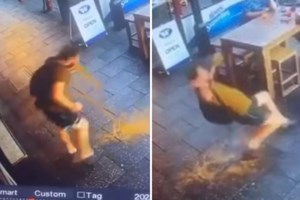 "Fire challenge": 50 χειρουργεία έκανε 11χρονος που κάηκε προσπαθώντας να κάνει ότι είδε στο TikTok [Βίντεο] - εικόνα 3