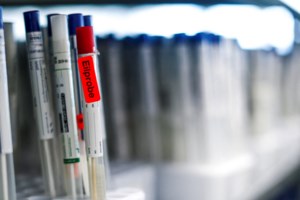 Κορονοϊός: "Κανένα τεστ δεν μπορεί να αποκλείσει 100% ότι κάποιος έχει κολλήσει" - Η εξήγηση Μαγιορκίνη - εικόνα 3