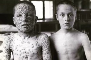 Ερευνα: Τα εμβόλια κατά του κορονοϊού "φρενάρουν" και τις μεταλλάξεις - εικόνα 2