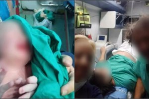 Φωτιά στην Αλεξανδρούπολη: Δραματική η κατάσταση - Μέσα στη Ροδόπη η πυρκαγιά, στόχος να μην περάσει την Εγνατία οδό - εικόνα 3