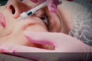 O ΕΟΦ προειδοποιεί για τη χρήση υαλουρονικού οξέως: Οι τρεις οδηγίες για την αποφυγή επικίνδυνων παρενεργειών - εικόνα 2