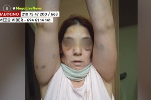 Άργος: Εξοργιστικός ο 34χρονος- "Είδα μονόπετρο και τρελάθηκα, 4-5 χαστούκια έφαγε- Εγώ λατρεύω τις γυναίκες" - εικόνα 4