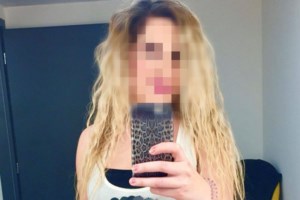 Επίθεση με βιτριόλι: Πέμπτο χειρουργείο για την Ιωάννα - Ένα κάθε δέκα μέρες για την άτυχη κοπέλα [Βίντεο] - εικόνα 2