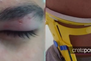 Απίστευτο: Δάσκαλος γυμναστικής στα Χανιά έπιασε από τον λαιμό 12χρονο μαθητή - εικόνα 2