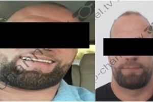 Πυροβολισμοί στη Θεσσαλονίκη με έναν τραυματία: Του έριξε μία στο πόδι και μία πιο ψηλά - Γνωρίζονται θύμα και θύτης - εικόνα 5