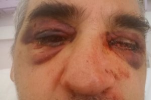 Τι συμβαίνει στη Μύκονο; - Οι παράνομες εκτός σχεδίου οικοδομές, ο ξυλοδαρμός του αρχαιολόγου και η παρέμβαση Μητσοτάκη - εικόνα 3