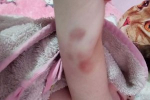 Πάτρα: "Είμαστε στην τελική ευθεία" -  Το μήνυμα του Τμήματος Ανθρωποκτονιών και το στοιχείο που συνδέει και τους τρεις θανάτους - εικόνα 3