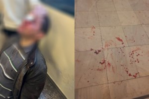 Επίθεση στη Νομική: "Τον χτυπούσαν με κράνη και λοστούς στο κεφάλι" - Τι ψάχνει η ΕΛΑΣ για τους οκτώ δράστες