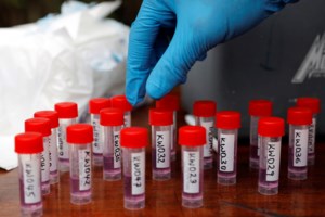 Νέα έρευνα: Ολλανδοί ανακάλυψαν αντίσωμα "ασπίδα" κατά της μόλυνσης από τον κορονοϊό