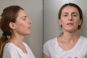 Πέτρου Ράλλη: Σπείρα "χτυπάει" αυτοκίνητα στα φανάρια - Πώς τα αδειάζουν αφού πρώτα... σπάσουν τους υαλοκαθαριστήρες