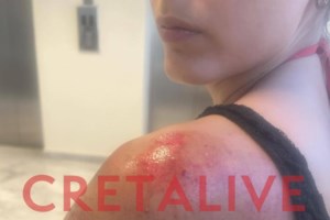 Άγριο ξύλο μετά... μουσικής σε κρητικό πανηγύρι - Πλακώθηκαν κάτοικοι δύο χωριών