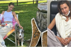 Εξαντλημένη από τη νόσο Lyme η Μπέλα Χαντίντ: Νέες, ανησυχητικές φωτογραφίες του σούπερ μόντελ - εικόνα 8