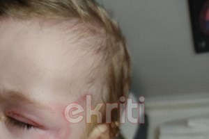 Κρήτη: Τι απαντά η ιδιοκτήτρια του σκύλου που δάγκωσε το βρέφος στην Αμμουδάρα