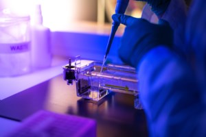 Παγκόσμιος συναγερμός για την ευλογιά των πιθήκων: Εξαπλώνεται στην Ευρώπη - Έκτακτη συνεδρίαση του Π.Ο.Υ - εικόνα 2