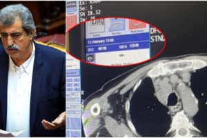 Ζαχαριάδης: Εχω βαρεθεί να απολογούμαι για τον Πολάκη - Να το λάβει υπόψη του και ο ίδιος