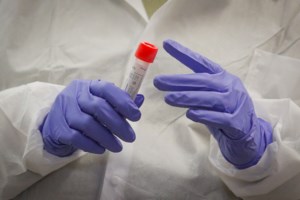 Τα γονίδια ευθύνονται κατά 50% για το αν θα αρρωστήσει κάποιος ελαφρά ή σοβαρά από κορονοϊό