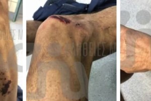 Τέμπη: "Τα εγκαύματα του Κυπριανού μοιάζουν με των πυροσβεστών" - Συγκλονίζει ο πατέρας θύματος της τραγωδίας - εικόνα 4