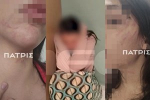 Έδεσσα: Σοκαριστικό βίντεο ντοκουμέντο - Ξυλοδαρμός 43χρονης από τον πρώην σύντροφό της - "Με χτυπούσε ακόμα και για ένα like" - εικόνα 2