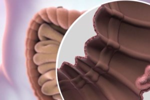 Διευκρινίσεις για τα self test από το υπουργείο Υγείας: "Δεν ανιχνεύουν αν κάποιος έχει καρκίνο στο παχύ έντερο"