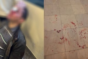 Επίθεση στη Νομική: Η καταδρομική έφοδος των 8 κουκουλοφόρων - "Με χτύπησαν με τον πυροσβεστήρα στο πρόσωπο" [βίντεο] - εικόνα 4