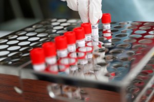 Καθηγητής Δημόπουλος: Απαραίτητη η πάνινη μάσκα όταν είμαστε ανάμεσα σε πολύ κόσμο