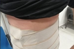 Βραζιλία: Έξι ασθενείς προσβλήθηκαν από τον ιό HIV αφού υποβλήθηκαν σε μεταμόσχευση μολυσμένων οργάνων - εικόνα 2