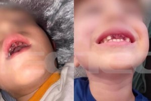 Δημοτικό σχολείο επαναφέρει τη στολή στους μαθητές - "Θυμίζει χούντα"- "Εκμηδενίζει τις ανισοτήτες από τα ακριβά ρούχα"