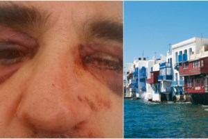 Η απάντηση του αντιδημάρχου Αθηναίων, Χρήστου Τεντόμα, για τα 800.000 ευρώ - Διατάχθηκε προκαταρκτική - εικόνα 2