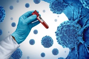 Γιαούρτι κατά του καρκίνου του παχέος εντέρου - Μπορεί να μειώσει τον κίνδυνο