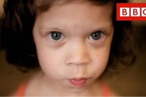 H ιστορία της 7χρονης Σοφιλένιας με σύνδρομο Rett: Εκκληση για εισαγωγή φαρμάκου από τις ΗΠΑ - εικόνα 2