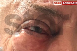 Θεσσαλονίκη: Σκηνές απίστευτης αγριότητας μέρα μεσημέρι - Ξυλοκόπησαν γιατρό μπροστά στο τρίχρονο παιδί του - εικόνα 3