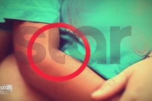 Λάρισα: Εκθεση "γροθιά" της παιδιάτρου που εξέτασε τα αδελφάκια - Οι αντιφάσεις της μητέρας για τα σημάδια στα κορμάκια τους - εικόνα 2