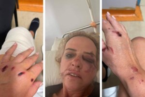 Καλαμάτα: "Δεν είπα ποτέ ότι με δάγκωσαν τα σκυλιά, αλλά η κατάσταση είναι ανεξέλεγκτη", λέει η 45χρονη [Βίντεο] - εικόνα 5