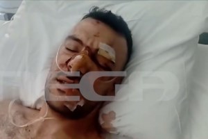 Κορινθία: Άγριος ξυλοδαρμός ιερέα που προσπάθησε να χωρίσει δύο άντρες που τσακώνονταν σε πανηγύρι