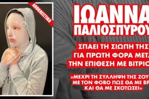 Επίθεση με βιτριόλι - Συγκινεί ο αδερφός της Ιωάννας: Η αδελφή μου το έχει αποδεχτεί - Είμαστε όλοι δίπλα της